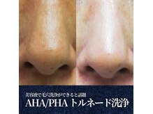 グレース 池袋本店(GRACE BEAUTY SALON)
