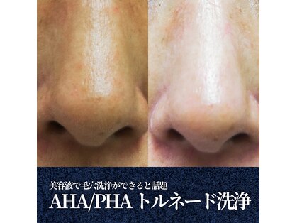 グレース 池袋本店(GRACE BEAUTY SALON)の写真