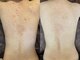 ノーブル 恵比寿店(NOBLE)の写真/少ない回数で結果を。
