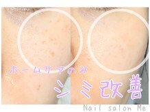 自分自身も体感した肌質改善、クリスティーナ正規取扱店◎