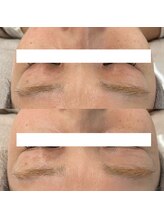 ヴェルシック(Belchic)/お悩みの方も多い瞼もお任せ