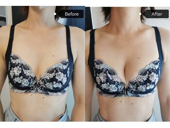 シークレット(Secret)/40代のお客様ビフォーアフター