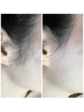 十美/【清潔感UP♪】before　after