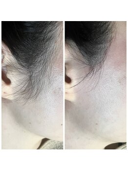 十美/【清潔感UP♪】before　after