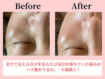 ココロ(COCORO)/美脳小顔矯正&毛穴洗浄