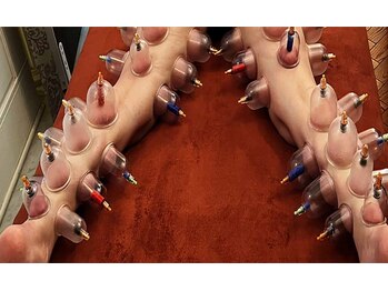 スイクウ ネオ(neo)/カッピング60分