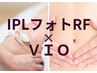【『新型IPLフォトRF』×『VIO脱毛』】＋首頭筋膜小顔エステケア付　¥9500
