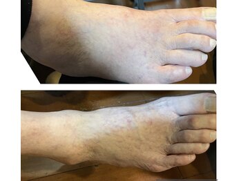 ヨサパーク ヴィヴァン(YOSAPARK Vivant)/ゾウ足にサヨナラ