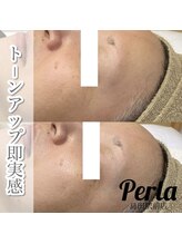 ぺルラ 島田駅前店(Perla)/光フェイシャル
