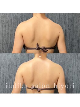 ヒヨリ(hiyori)/《before/after》上半身