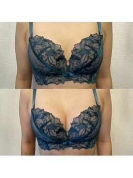 ハル 水戸市(HaRu)/バストメニューも◎