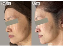 あすはれ/トラブル知らずの見惚れる素肌へ