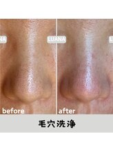 ルアナ 北谷店/毛穴洗浄毛穴ケア 《沖縄/北谷》