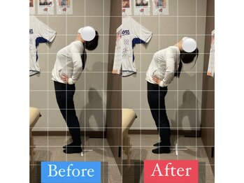 ナオル整体 宮崎院(NAORU整体)/30代女性施術事例【反り腰改善】