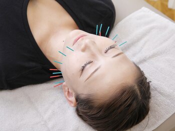 ネイビー鍼灸指圧治療院 那覇久米店(NAVY鍼灸指圧治療院)/美容鍼でお肌整えます