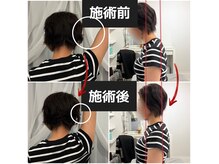 肩こり施術◎姿勢改善/猫背/巻肩/整体/マッサージ/