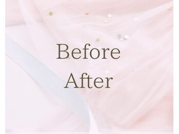 アイリス(AIRIS)/