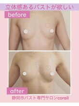 コライユ(corail)/ビフォーアフター