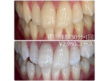 ホワイトニングルーム 横浜店(Whitening Room)/セルフホワイトニング/横浜