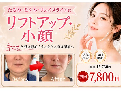 レフアの写真