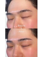 眉毛男子 新宿店/Before/After