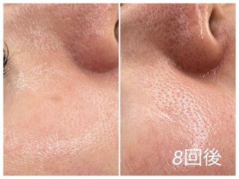 アロマ(AROMA)の写真/年末年始の写真で老け見えしたくない50代へ!シミ・たるみ・毛穴を今からケアして自信の持てる素肌に