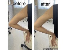 エンチャント(ENCHANT)/二の腕ぷるぷるも卒業！