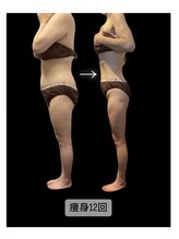 エステサロン ジュブリー/［痩身・下半身・脚・太もも］