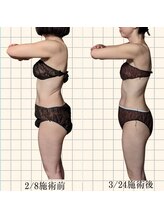 ルマ(Rumah)/筋膜リリースで痩身効果！