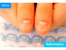 ネイルカンパニー/