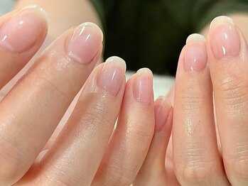 シャンス(chance)の写真/巻き爪や角質ケア、フットケアもお任せ!ケア&ネイルに特化した今注目の美爪育成サロン♪オフのみも大歓迎◎