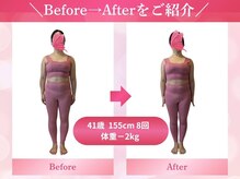 キュートレ 東日本橋 人形町店(Cuetre)/【ビフォアフ5】41歳 8回