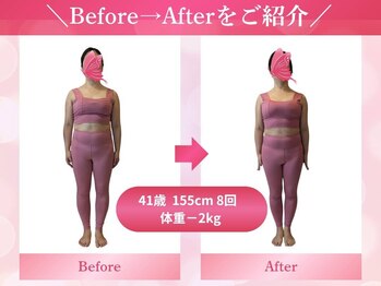 キュートレ 東日本橋 人形町店(Cuetre)/【ビフォアフ5】41歳 8回