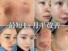 リメイク 銀座(REMAKE)