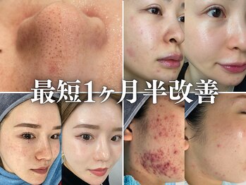 リメイク 銀座(REMAKE)