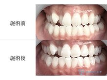 シュシュ(ChouChou)