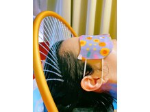 漢方頭療