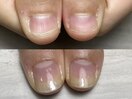 自爪育成コース