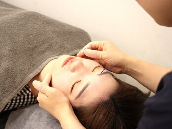 神戸岡本鍼灸整骨院の写真/【岡本/摂津本山】駅からすぐの好立地♪清潔感のある院内で受ける女性に大人気の美容鍼でお顔のお悩み解消!