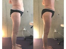 サプナジー(Suppnrgy)/カスタムトリートメント