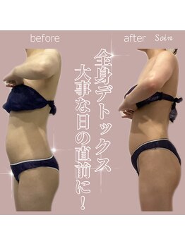 ソワン(Soin)/20代　アーユルヴェーダ