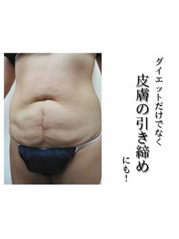 サイズダウンを目指したい