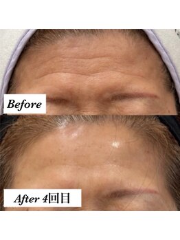 ミランオオサカ(MIRAN OSAKA)/