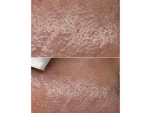 サイ(Sai)/1回のケアで夕方メイクに変化有