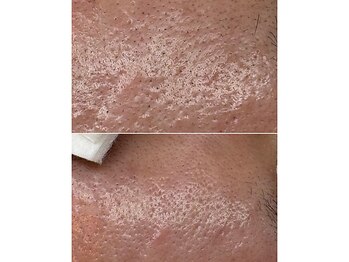 サイ(Sai)/1回のケアで夕方メイクに変化有