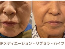 アストリア(ASTORIA)/若々しい見た目へ