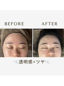 モア(moa)/透明感爆誕!! 肌管理