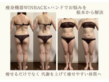 エソール(essor)/WINBACKで効果的痩身ダイエット