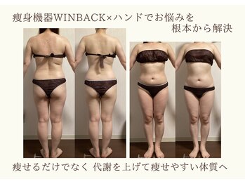 エソール(essor)/WINBACKで効果的痩身ダイエット