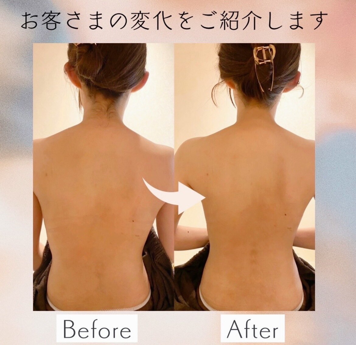 西18丁目駅でEMSが人気のエステサロン｜ホットペッパービューティー